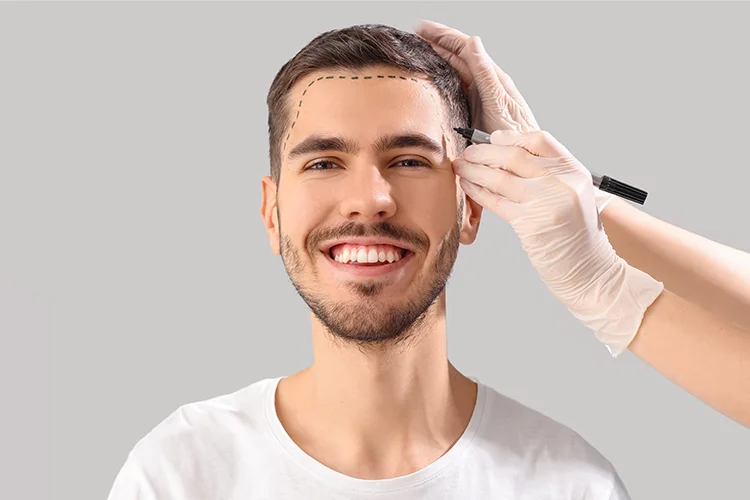 Hair transplant procedure